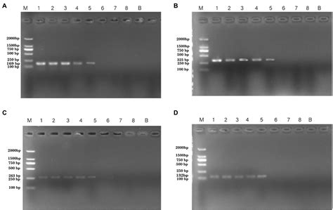 Pseudomonas aeruginosa Detection Using Conventional PCR .